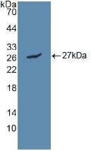 Polyclonal Antibody to Lipase, Hepatic (LIPC)