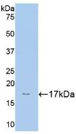 Polyclonal Antibody to Hexokinase 1 (HK1)