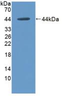 Polyclonal Antibody to Hexokinase 1 (HK1)