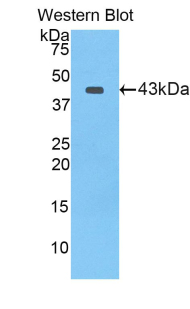 Polyclonal Antibody to Lactoferrin (LTF)