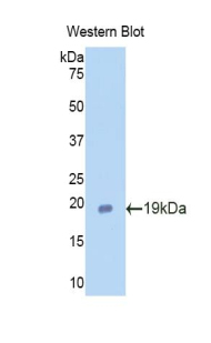 Polyclonal Antibody to Lactoferrin (LTF)