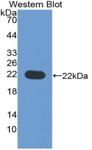 Polyclonal Antibody to Cluster Of Differentiation 276 (CD276)