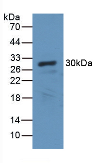 Polyclonal Antibody to Carbonic Anhydrase II (CA2)