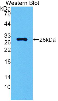 Polyclonal Antibody to Carbonic Anhydrase II (CA2)