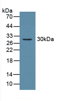 Polyclonal Antibody to Carbonic Anhydrase II (CA2)