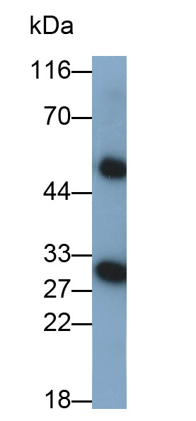 Polyclonal Antibody to Carbonic Anhydrase II (CA2)