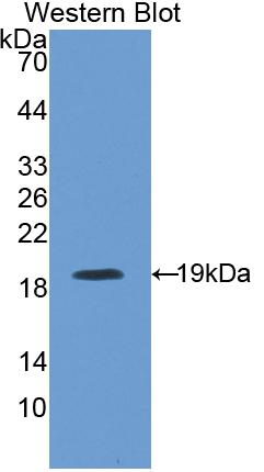 Polyclonal Antibody to Complement Factor P (CFP)