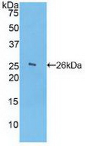 Polyclonal Antibody to Ficolin 1 (FCN1)