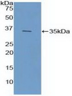 Polyclonal Antibody to Ficolin 1 (FCN1)