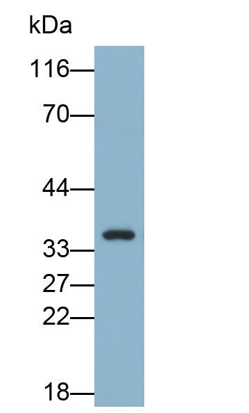 Polyclonal Antibody to Ficolin 1 (FCN1)