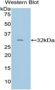 Polyclonal Antibody to Programmed Cell Death Protein 1 Ligand 2 (PDL2)