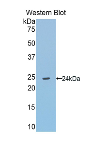 Polyclonal Antibody to Angiotensinogen (AGT)