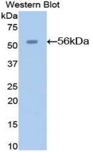 Polyclonal Antibody to Angiotensinogen (AGT)