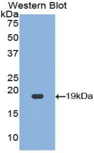 Polyclonal Antibody to Hypoxia Inducible Factor 1 Alpha (HIF1a)