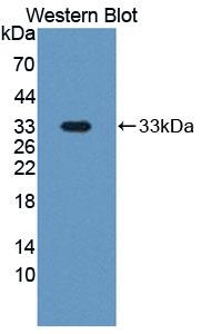 Polyclonal Antibody to Pregnancy Associated Plasma Protein A (PAPPA)