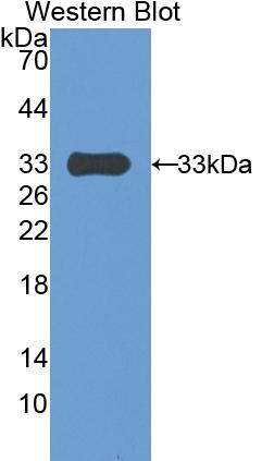 Polyclonal Antibody to Pregnancy Associated Plasma Protein A (PAPPA)