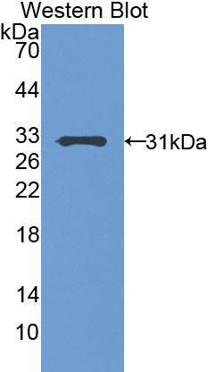 Polyclonal Antibody to Pregnancy Associated Plasma Protein A (PAPPA)