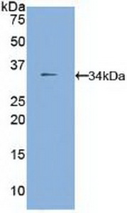 Polyclonal Antibody to Fucosidase Alpha L1, Tissue (FUCa1)