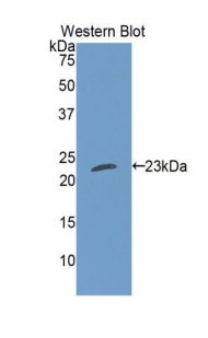 Polyclonal Antibody to Cardiotrophin 1 (CT1)