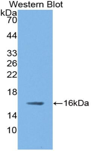 Polyclonal Antibody to Nitric Oxide Synthase 1, Neuronal (NOS1)