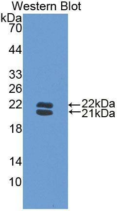 Polyclonal Antibody to Haptoglobin (Hpt)