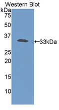 Polyclonal Antibody to Haptoglobin (Hpt)