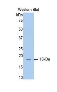 Polyclonal Antibody to Death receptor 5 (DR5)