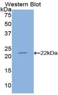 Polyclonal Antibody to Parathyroid Hormone Related Protein (PTHrP)