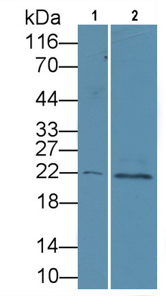 Polyclonal Antibody to Parathyroid Hormone Related Protein (PTHrP)