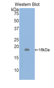 Polyclonal Antibody to Parathyroid Hormone Related Protein (PTHrP)