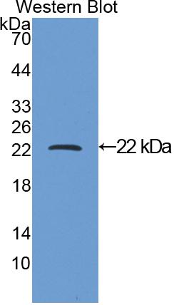 Polyclonal Antibody to Parathyroid Hormone Related Protein (PTHrP)