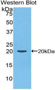 Polyclonal Antibody to Coagulation Factor II (F2)