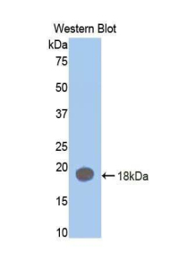 Polyclonal Antibody to Coagulation Factor II (F2)