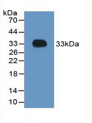 Polyclonal Antibody to Coagulation Factor II (F2)