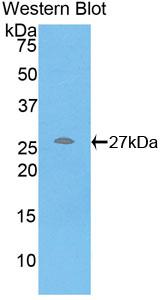 Polyclonal Antibody to C Reactive Protein (CRP)