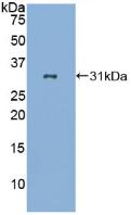 Polyclonal Antibody to Cluster Of Differentiation 86 (CD86)