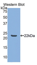 Polyclonal Antibody to Tumor Necrosis Factor Ligand Superfamily, Member 14 (TNFSF14)