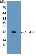 Polyclonal Antibody to Von Willebrand Factor (vWF)