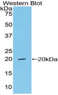 Biotin-Linked Polyclonal Antibody to Von Willebrand Factor (vWF)