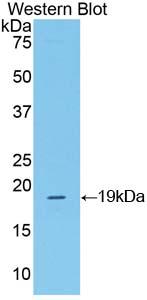 Polyclonal Antibody to Corticotropin Releasing Factor (CRF)