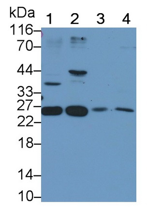 Polyclonal Antibody to Corticotropin Releasing Factor (CRF)