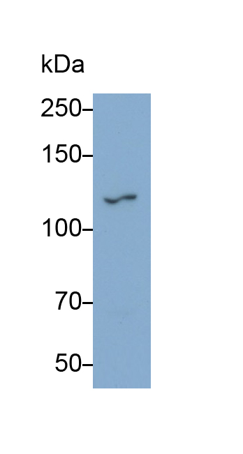 Polyclonal Antibody to Nitric Oxide Synthase 2, Inducible (NOS2)