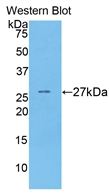 Polyclonal Antibody to Coagulation Factor IX (F9)