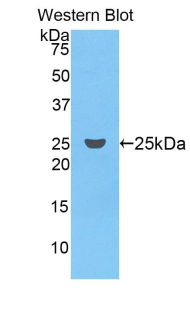 Polyclonal Antibody to Coagulation Factor IX (F9)