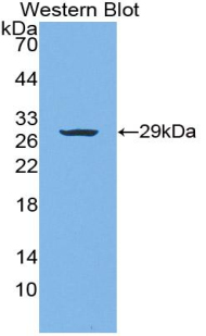 Polyclonal Antibody to Von Willebrand Factor A Domain Containing Protein 1 (vWA1)