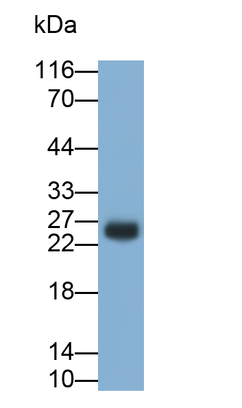 Polyclonal Antibody to Prolactin (PRL)