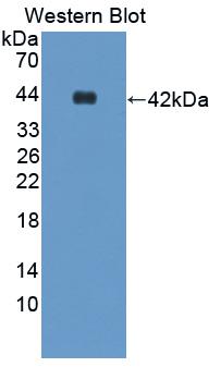 Polyclonal Antibody to Resistin (RETN)