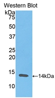 Polyclonal Antibody to Resistin (RETN)