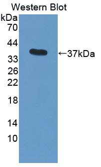 Polyclonal Antibody to Resistin (RETN)