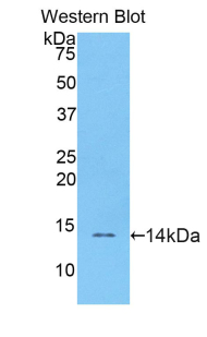 Polyclonal Antibody to Resistin (RETN)